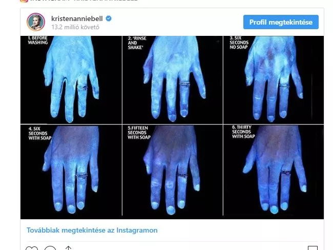 Ezért énekelj kézmosás közben, és további tippek koronavírus idejére